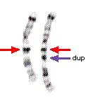 Structural aberrations (1) Duplication ( 중복 ) Deletion ( 결실 )