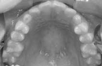 2-2.  2-3. Initial 3D Dental-CT.