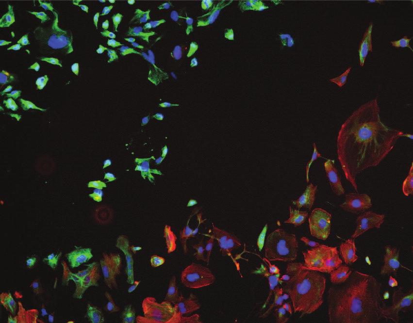 cells: AF (red) and IF (green) (a) Boundary region