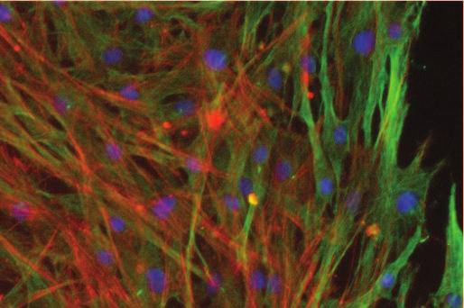 fibroblast cells treated by