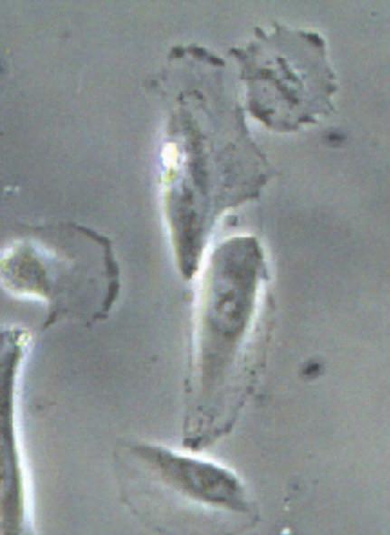 cells after Trypsin-