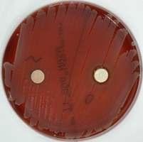 Propionibacterium acnes control Horse oil con con oil