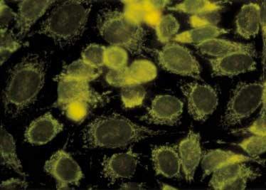 416 백현문 남정현 송정수외 3 인 콘드리아, 리보좀 (ribosomal), 세포골격계 (cytoskeletal) 등의항체유형이나 [1], 이들이실제로해당항체를나타내는지에관한연구는많지않다. 본연구에서는항핵항체검사에서세포질에염색이관찰된검체를대상으로염색양상을살펴보고그에따른임상적특징과기타자가항체와의공존여부등을관찰하고자하였다. 재료및방법 1.