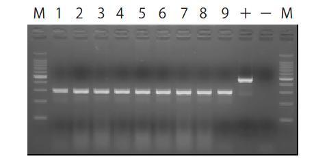 MiniBEST-Viral RNA/DNA MiniBEST-Viral RNA/DNA (9766A) 다양한샘플로부터추출 다양한 sample (plasma, whole blood, virus stock