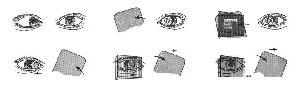 (E) The cover is again transferred, and a prism of greater power is held before the right. (F) Transfer of cover to the left does not elicit fixation movement of the right eye.