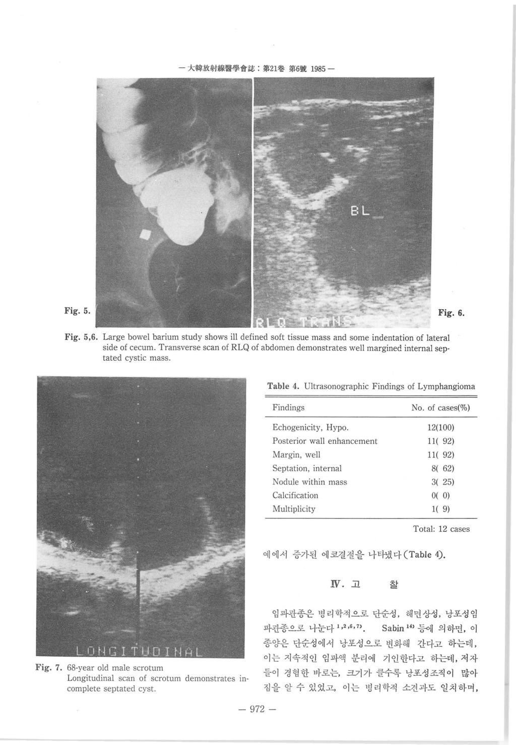 大헬放射線훌훌學會誌 : 第 21 卷第 6 짧 1985 - Fig.5. Fig.6. Fig. 5,6. Large bowel barium study shows ill defined soft tissue mass and some indentation of lateral side of cecum.