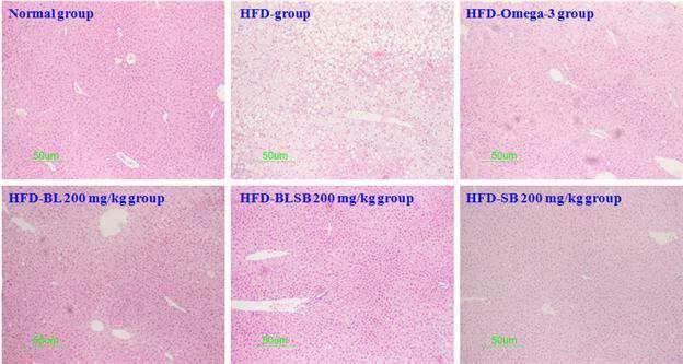 10 大韓本草學會誌 Vol. 29 No. 6, 2014 다. HDL-C 의경우 HFD에비하여 Omega-3, BL, SB, 그리고 BLSB 투여군에모두증가를나타내었다.