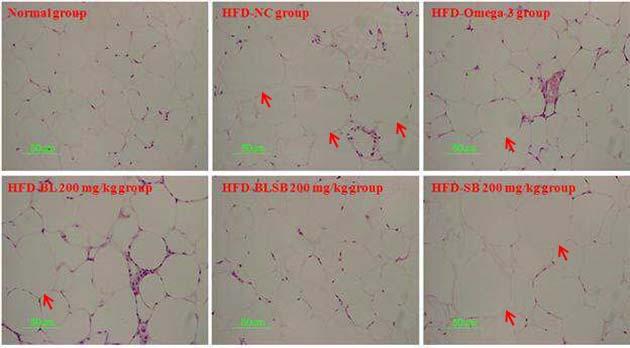 竹葉과黃芩복합물의항비만효과 11 Fig. 4. Effect of bamboo leaf, Scutellaria baicalensis and their combination extracts on histological profiles of epididymal adipose tissue in HFD-induced obese mice.