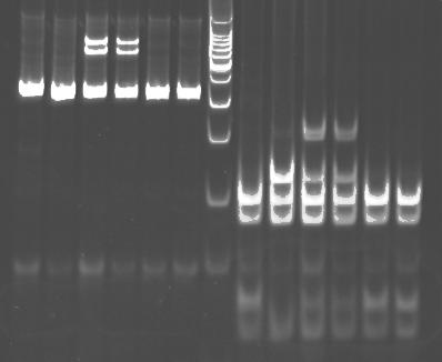 - 분자유전학적검사로진단된 Ornithine transcarbamylase deficiency 1 예 - 1 2 3 4 5 6 7 8 9 10 11 12 13 Fig. 2. Identification of the mutation (heterozygote type) in exon 8 of the OTC gene.