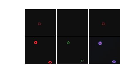 주간건강과질병 제 11 권제 5 호 A B Stimulation SPL NK-depleted SPL NK PGA Medium BMDMs ND NK+BMDMs PGA 2 4 6 8 1 IFN-γ (pg/ ml ) NK1.1 IFN-γ Merge Figure 1.