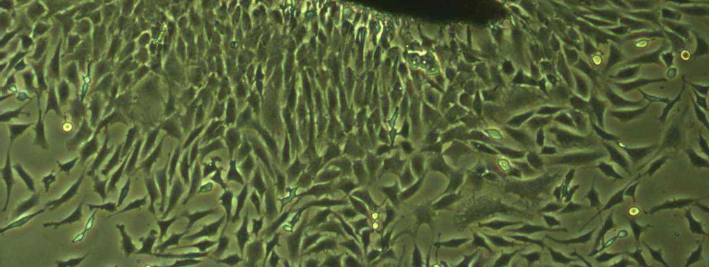 fibroblasts에서 mrna가발현된다는보고가있어 (Wang et al.