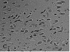 Apoptosis 는정상적인세포의성장과정이나 병리적인원인등에의해일어나며형태학적으로 는세포의크기축소, 염색질의응축및 apoptotic body 등을특징으로하는세포사의한형태로서 1972 년에 Ker 등에의해소개된이후의학계나 생물학계에서가장활발히연구되고있는분야들 중의하나이다 16,17).Apoptosis 가나타나는시기는 저자에따라차이가있다.