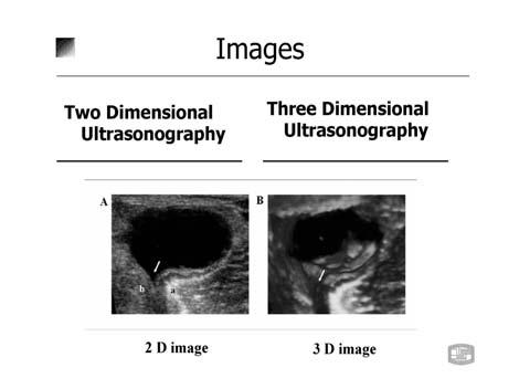 Ji Hyeon Ju:Application of 3D Ultrasonography