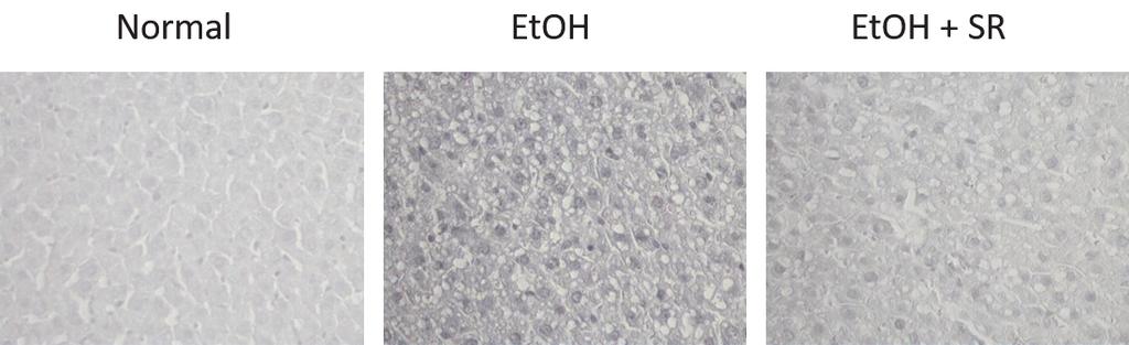 김범회: 알코올로 유도된 흰쥐의 간 지방 형성에 황금 추출물이 미치는 효과 5 2 군에서 Normal군에 비해 간조직으로의 지질침윤(lipid in- 로 EtOH+SR군에서는 37.6±4.4개/1.