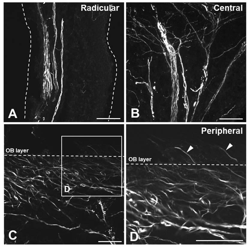 치수의 Peripherin 발현 35 Fig. 1. Photomicrograph showing peripherin+ axons in the rat maxillary molar pulp.
