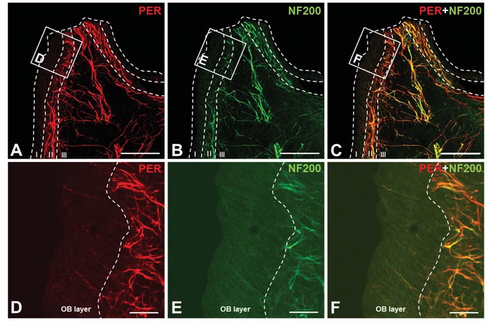 36 김태헌, 배용철, 양은선 Fig. 2. Photomicrographs showing colocalization of peripherin+ axons with NF200 in the rat maxillary molar pulp.