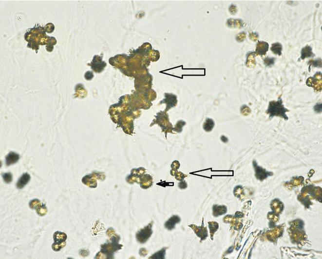 (A) CUI-17-01 uric acid crystal (original magnification 400).