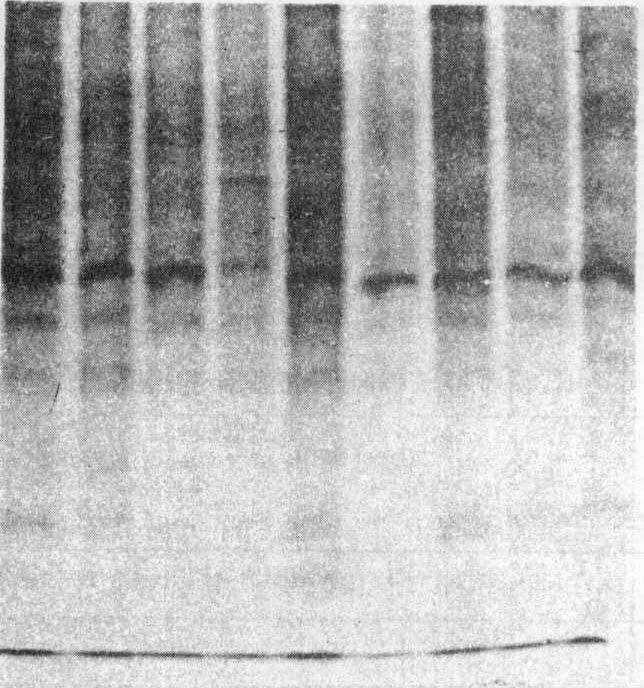 고찰 Coagulase 양성포도상구균은다양한동물줌의 3-72% 에서코와구강에서인정되었다. 1976 년 Hajek 는생화학적반응파세포벽의 protein 조성등에서 S.aμ re μs 와상이한 S.aμ reαs biotype E 와 F 로써전에분리된바있는 coagulase 양성포도상구균의 S. interedius 를언급했다 10, 11) R.