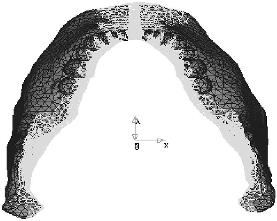 incisors) Fig 12. Deformed and undeformed pattern of experimental group 1. kpa kpa Fig 13.