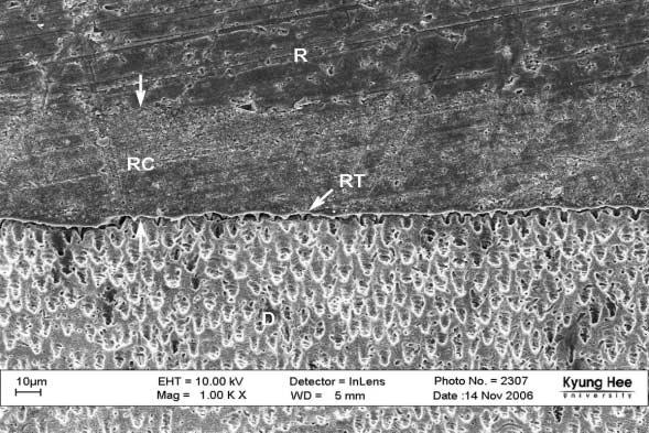 a b c d Figure 8. FE-SEM photograph illustrating the resin/dentin interface ( 1000). a. Cross-sectioned image of Variolink II.