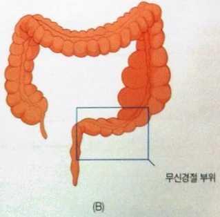 S상결장이나직장부위에부교감신경절결여 (A)