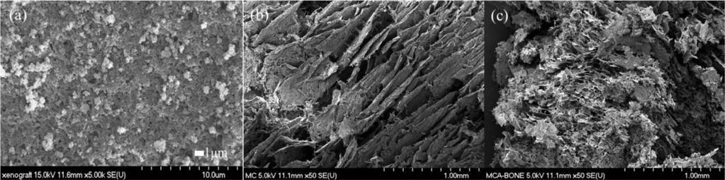 김 진 천서영 국민석 이창문 이기영 284 Figure 3. SEM images of the BGM (a); MC/XT gel (b); MC/XT-BGM gel (c) after freezing dry. Figure 4.