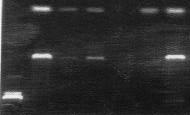 bar 4-5 2. bar (. 5-3-b). 4. PCR bar 2. PCR bar Forward primer Reverse primer 21mer.