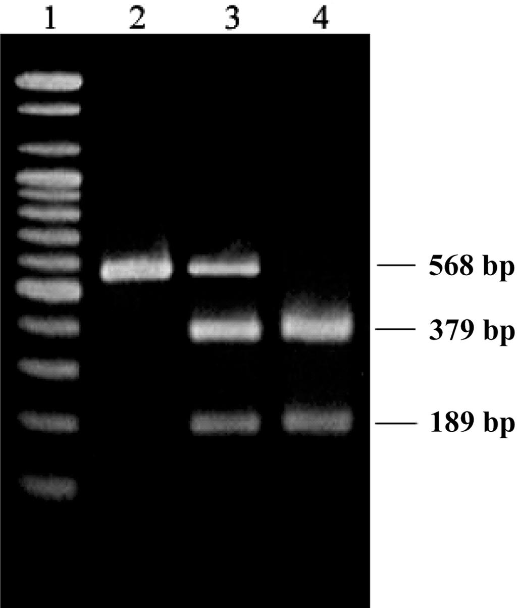 126 Áû xá Á Á Double strand based DHPLC RFLP w PCR e š 95 o C 10 k z 45 x w x k z DHPLC w. f 58 o C w DNA ù t xk w x w. Fig. 3 G/C genotype 3 vj ùkûš, G/G genotype v j xk. Fig. 1. Analysis of a single nucleotide polymorphism at -174 (G/C) in the IL-6 gene promoter.