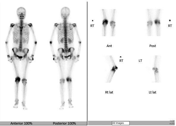 RT, right; Ant, anterior; Post, posterior; LT, left; Rt lat, right lateral; Lt lat, left lateral.