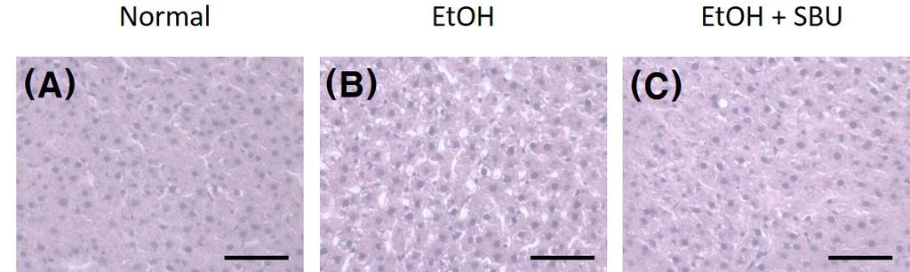 한방비만학회지 제18권 제2호, 2018 정상적인 간 조직의 형태를 나타낸 반면, EtOH군에서는 Normal군에 비해 면역반응이 뚜렷이 증가되는 것이 관찰 8주간의 알코올 투여로 인해 간 조직의 괴사 및 지방방울 되었다. EtOH+SBU군에서도 면역반응이 증가되었으나 (fat droplet)의 형성을 뚜렷이 관찰할 수 있었다.