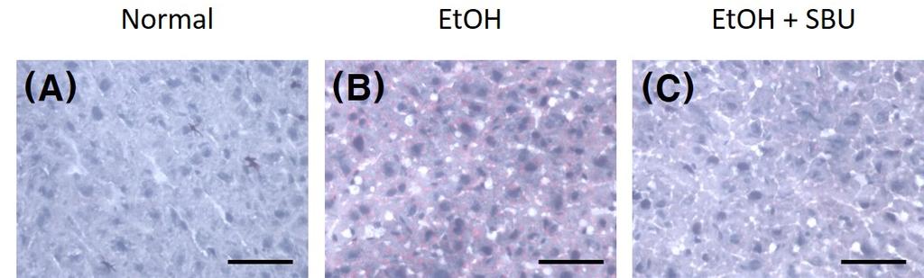 Oil Red O 염색을 시행한 결과에서도 EtOH군과 치화하기 위하여 일정 면적에서 양성반응을 보인 세포의 EtOH+SBU군에서 Normal군에 비해 간 조직으로의 지질 개수를 측정한 결과에서는, Normal군에서 양성반응세포수 축적(lipid accumulation)이 상대적으로 많이 관찰되었으나, 가 4.9±0.9개/1.