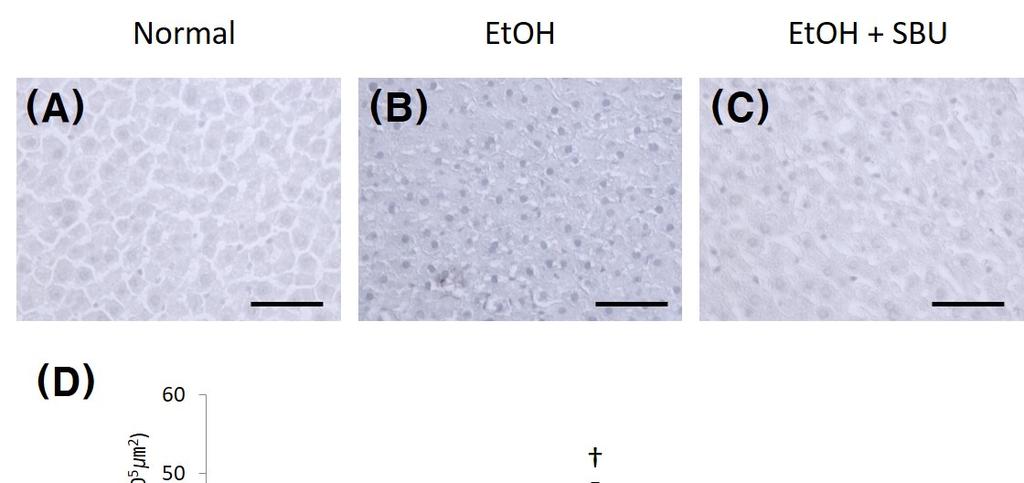 김범회 : 흰쥐의알코올유발성간손상에실비음 ( 實脾飮 ) 이미치는보호효과 Fig. 4. Immunohistochemical staining for tumor necrosis factor-α (TNF-α) in liver sections from Normal, EtOH, and EtOH+SBU groups.