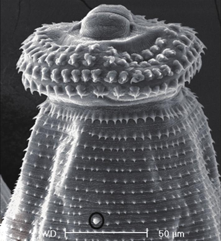 spines, a cervical papilla (encircled), and an anus.