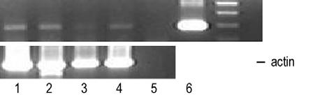 HY Lee et al.: Comparison of ELISA and microimmunofluorescence for Chlamydia antibody Figure 1. PCR for C. pneumoniae from nasopharyngeal swabs. Lane 1, 2 and 4 are positive samples for C.