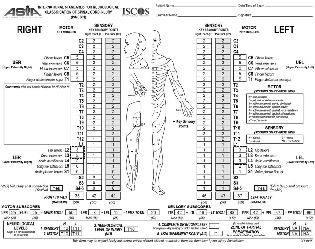 Jun-Yeong Seo et al Volume 25 Number 2 June 30 2018 Fig. 4. Worksheet of an imaginary patient with a spinal cord injury whose American Spinal Injury Association (ASIA) impairment scale score is D.