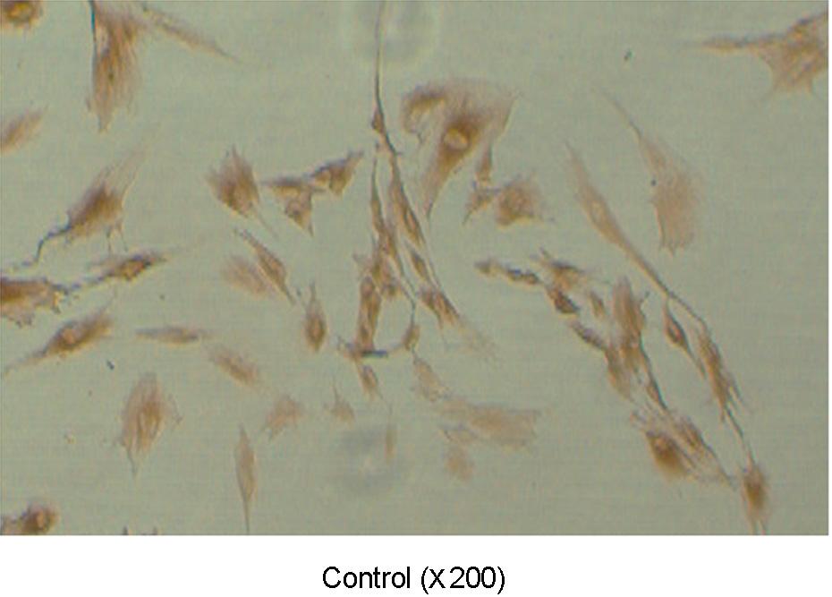 대한생식의학회지 A B Figure 1. (A) Immunocytochemical images of cultured human endometrial cells. Over 95% of cultured endometrial cells express HOXA10.