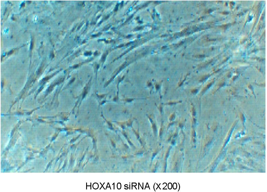 (B) RT-PCR analysis for HOXA10 expression in cultured human endometrial cells.