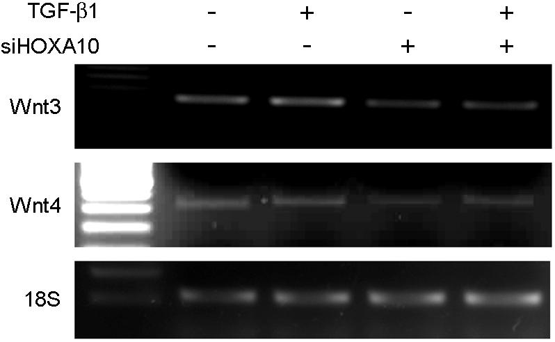 HOX, homeobox; sirna, small interfering RNA; COX, cyclooxygenase; TGF, transforming growth factor; PRL, prolactin. Figure 4. Effect of HOXA10 sirna on Wnt3 and Wnt4 expression.