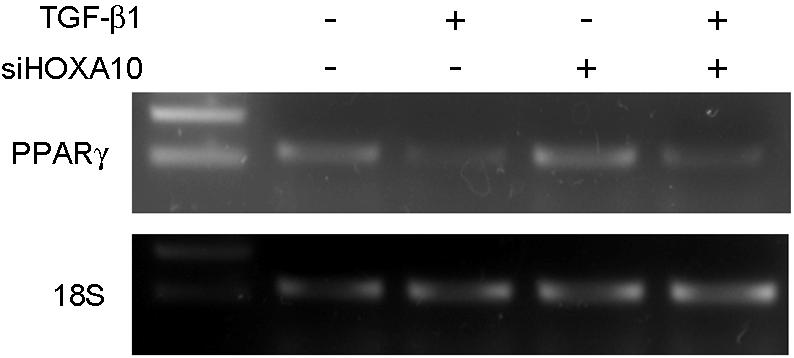 제 37 권제 3 호, 2010 이창세 박동욱 박찬우 김태진 Figure 5. Effect of HOXA10 sirna on peroxisome PPAR-γ expression. TGF-β1 (10 ng/ml, for 48 hr) inhibited PPARγ mrna expression.