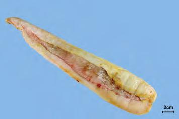 수조기 Nibea albiflora (Richardson) 또는철갑상어 과 [Acipenseridae] 에속하는철갑상어 Acipenser sinensis Gray 등의부레를사용한다고하였다.
