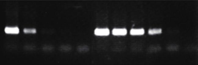 0 kb High efficient Taq DNA polymerase (Company A) Sample : Human genomic DNA Target : β-globin gene Cycling condition : 94, 2 min. 94, 30 sec. 60, 30 sec. 72, 1 min.