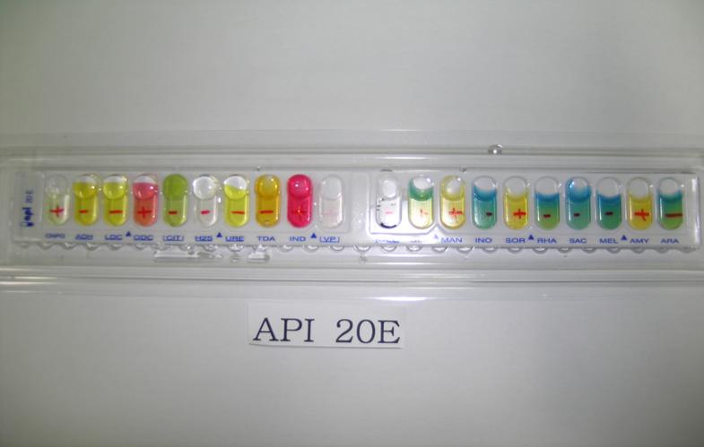 Growth of API 20E, TSI and urease test after 24 hours of incubation at 35-37 5.