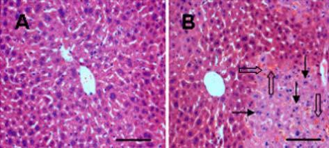 Proteomic analysis of liver Injury 71 w. MALDI-TOF MS-FIT (http:// prospector.ucsf.edu/ucsfhtml13.4/msfit.htm) ProFound (http://129.85.19.192/profound_bin/webprofound.