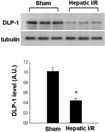 Figure 4. Western blot analysis of dynamin-1-like protein (DLP- 1) in liver tissue of sham-operated and ischemia/reperfusionoperated animals. Each lane represents an individual experimental animal.