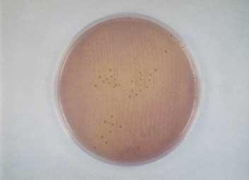 Escherichia coli O157 의산처리후배양법과증균후 PCR 법의비교 333 1 2 3 4 5 6 7 8 1,000 bp 500 bp 225 bp Fig. 1. Many colorless colonies without pink colonies are shown in 0.