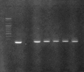 coli O157 CFUs/g of stool CFUs of E. coli O157 Colony color Abbreviations: CT-SMAC, cefixime-tellurite-sorbitol MacConkey; CFU, colony forming unit. 고 Concentration of cefixime 0.05 mg/l 0.1 mg/l 0.