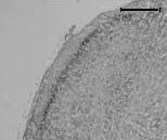 마의 CA1, CA3 그리고치상회에서 BDNF mrna 발현을보여주며, quetiapine 단독처치군이대조군에비해치상회에서 BDNF mrna 양을증가시켰음을보여준다.