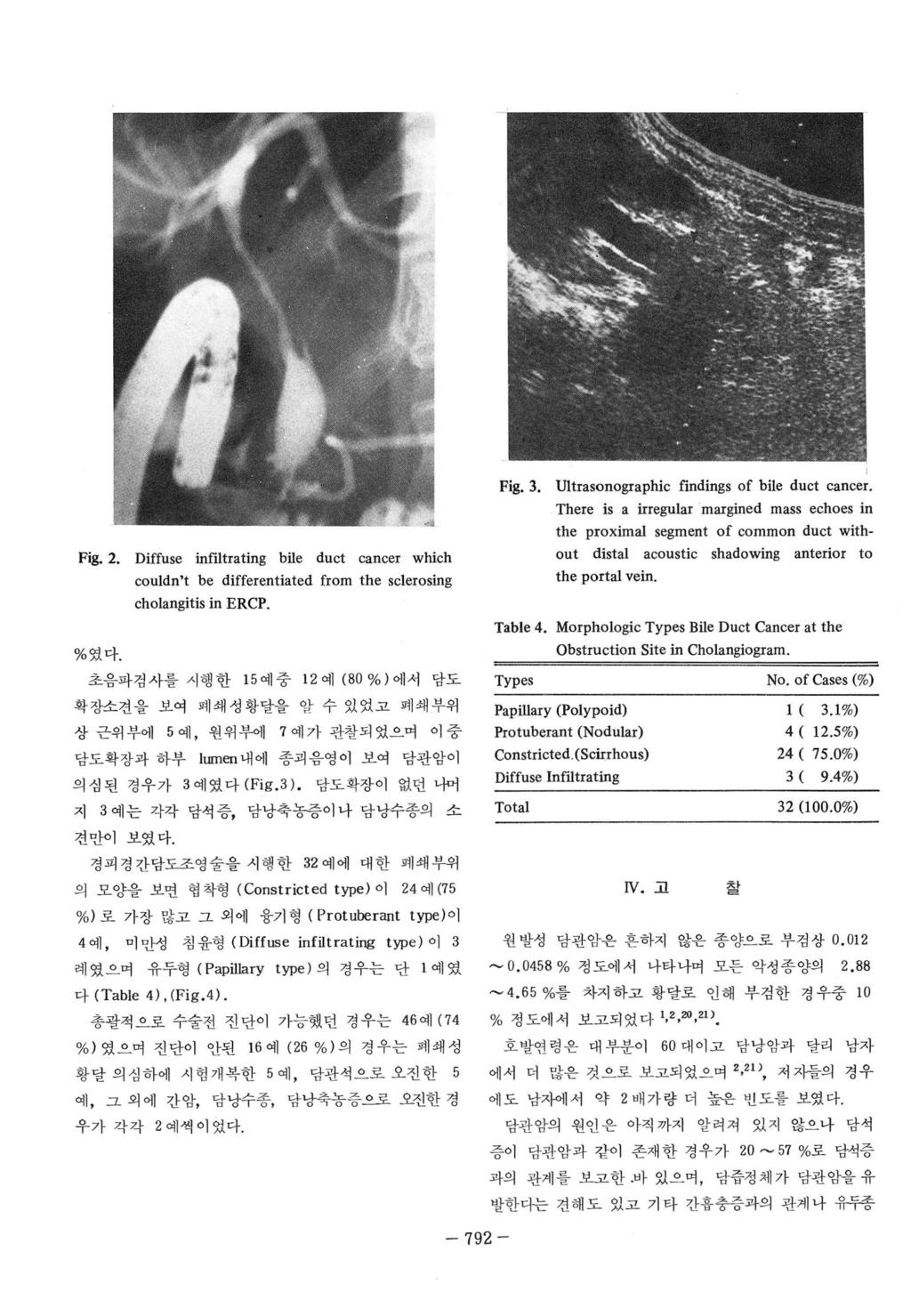 Fig. 2. Diffuse infiltrating bile duct cancer which couldn t be differentiated from the sclerosing cholangitis in ERCP. % 였다. 초음파검사를시행한 15 예중 12 예 (80 % ) 에서담도 Fig. 3. U!
