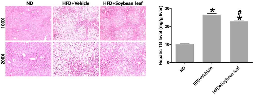 콩잎추출물의 지방간 억제 효과 199 Fig. 3 Effect of soybean leaf extract on liver weight in high-fat diet-fed mice.
