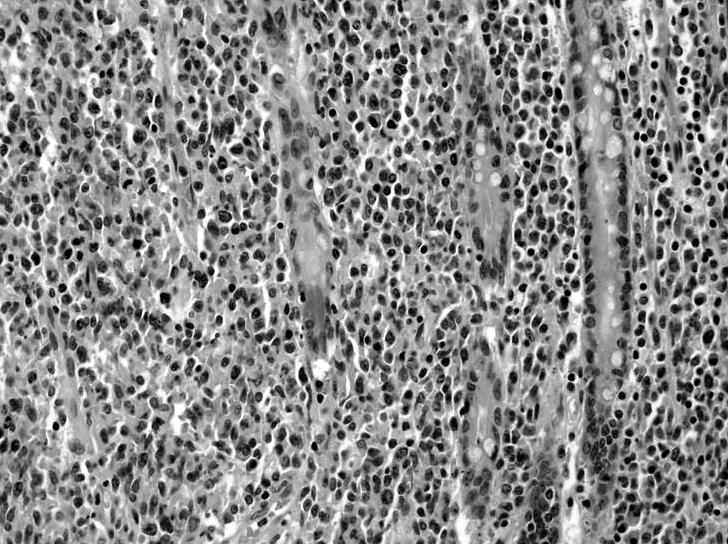 identified by gross pathology (arrows).